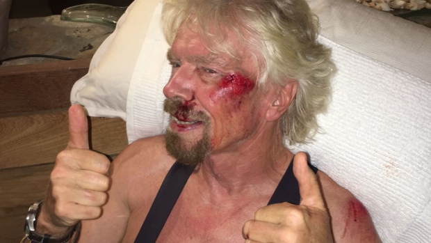 Richard Branson gives the thumbs-up after his biek accident in the British Virgin Islands